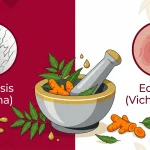 Psoriasis vs Eczema: How Ayurveda Tells Them Apart and Treats Both at the Root